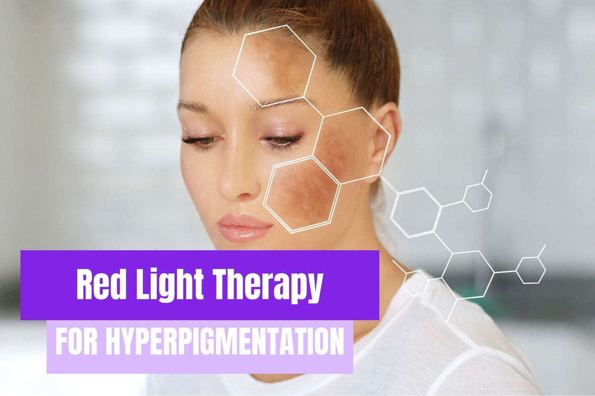 Does Red Light Help With Hyperpigmentation Novaalab NovaaLab