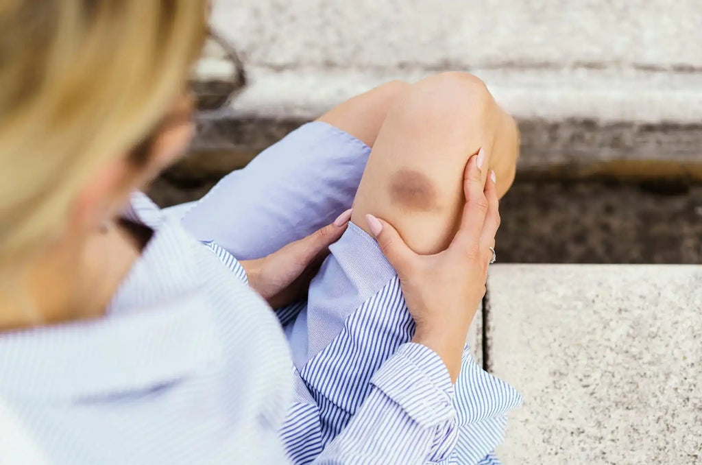 Red Light Therapy for Bruises: How It Works to Help Them Fade Faster