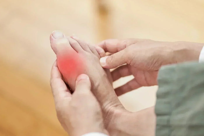 Red Light Therapy for Gout: Using Light to Manage Painful Flares