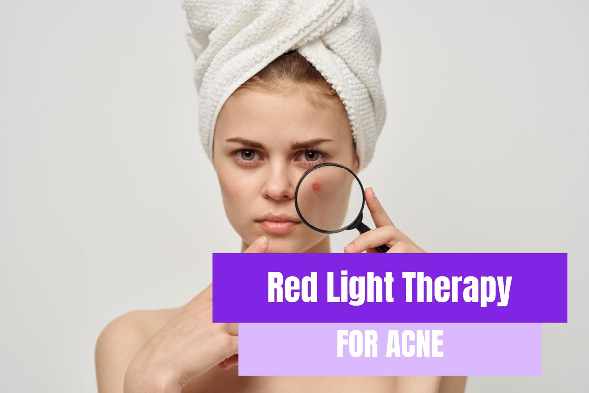 Red Light Therapy For Acne Can It Help? Novaalab NovaaLab