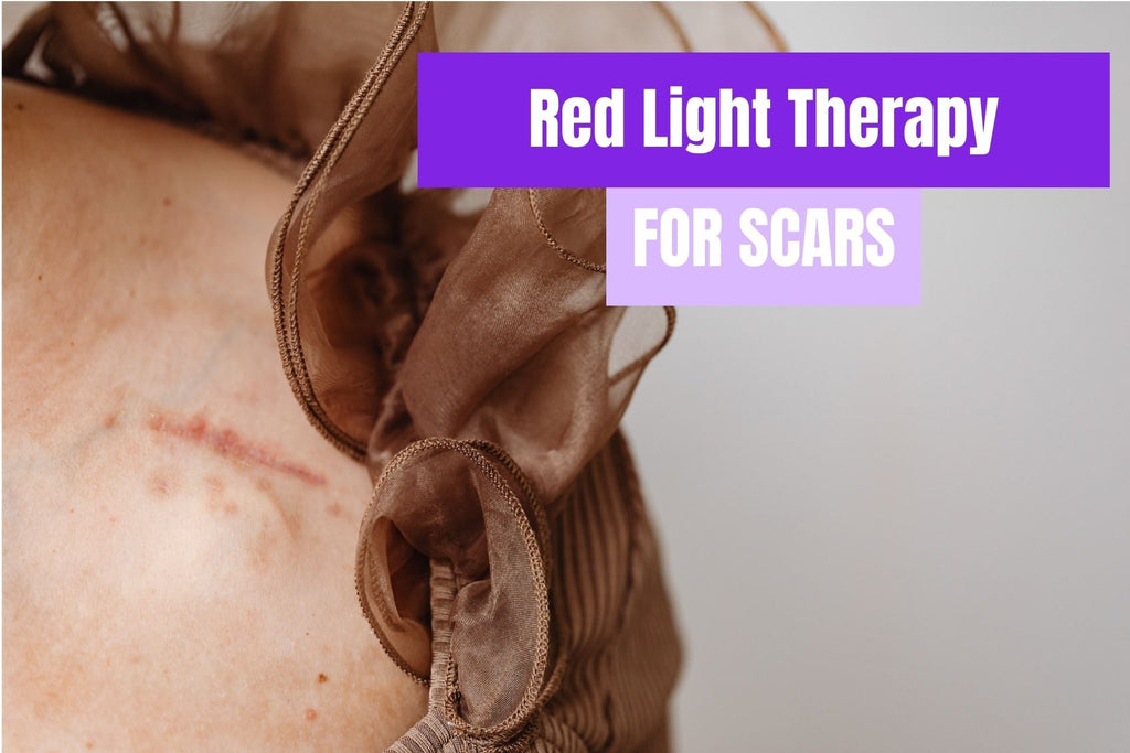 Does Red Light Therapy Help With Scars?