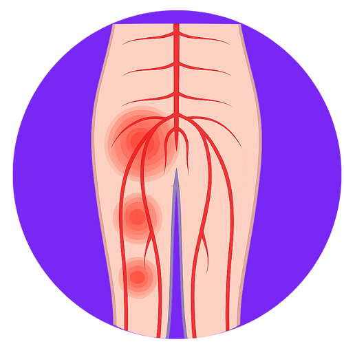 Hip Pain